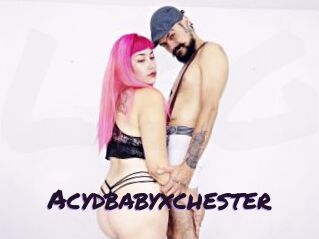 Acydbabyxchester